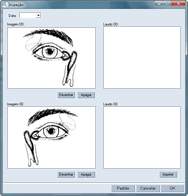 Software Médico para Oftalmologia